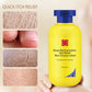 🔥Winter Discount-50% OFF⏰Deep Moisturization Itch Relief Non-Greasy Lotion