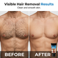 🧔💨 Men's Gentle Hair Removal Cream – No Razor, No Pain, No Irritation | Smooth in 5 Mins ⏱️✨
