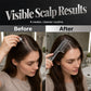 💆 50% OFF! ✨ Precision Liquid Applicator Comb for Scalp Care – Clear-Body Comb with 6 Rounded Rolling Tips, Even Flow Delivery & Gentle Rolling Contact – Precise Controlled Application for Daily Hair & Scalp Treatment Routine 💧