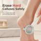 ✨ 50% OFF Today! 🦶 Foot Callus Remover Tool – Easy Home Pedicure File for Removing Dead Skin & Rough Heels