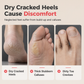 ✨ 50% OFF Today! 🦶 Foot Callus Remover Tool – Easy Home Pedicure File for Removing Dead Skin & Rough Heels